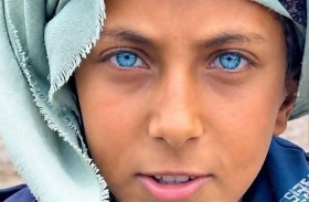 عينا طفل يمني تحولانه إلى «ترند»